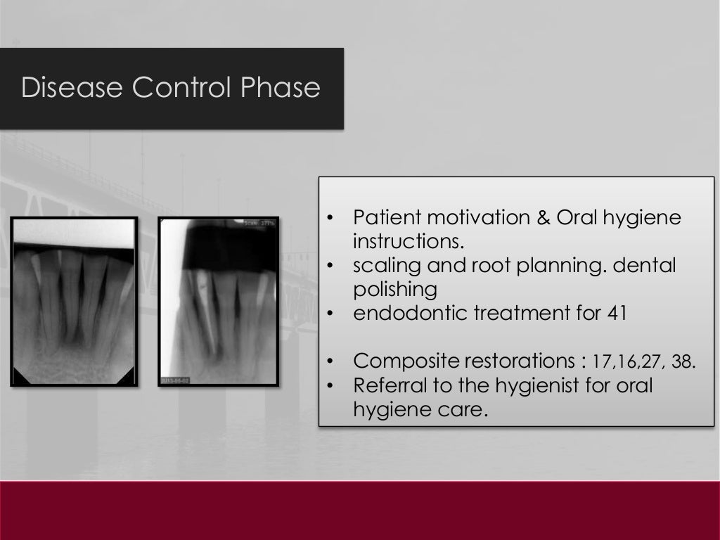 Dental clinical case presentation