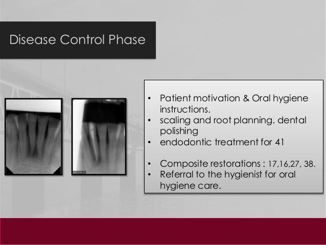 Dental case studies for students image