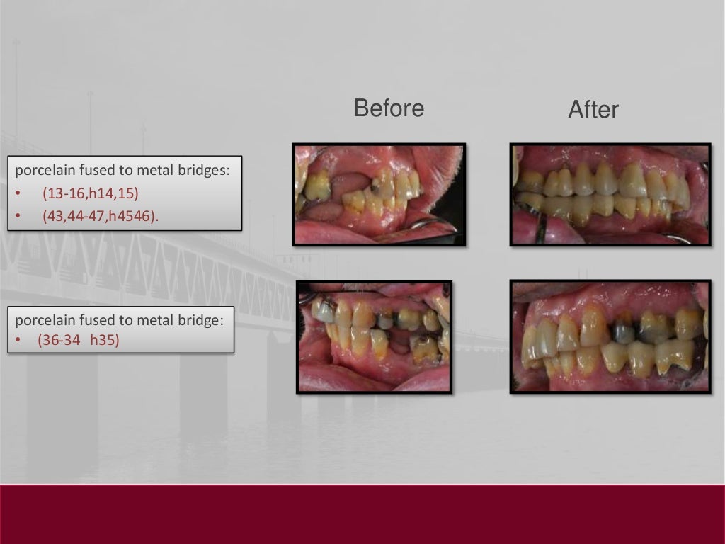 Dental clinical case presentation