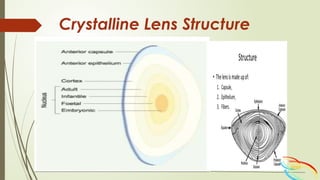 Cataract Structure CLINICAL Presentaton OF CATARACTS-4.pptx