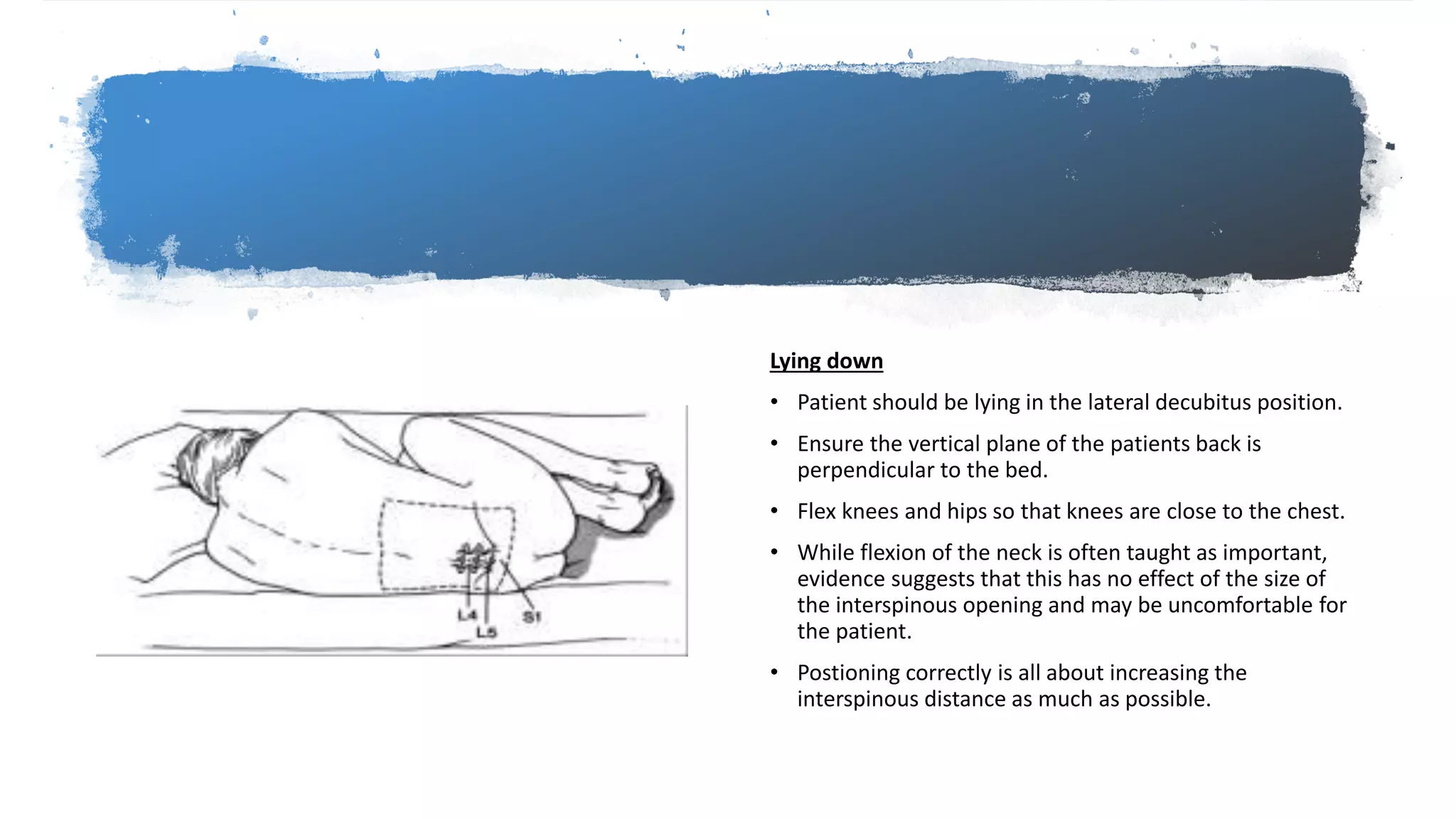 Lying down
• Patient should be lying in the lateral decubitus position.
• Ensure the vertical plane of the patients back is
perpendicular to the bed.
• Flex knees and hips so that knees are close to the chest.
• While flexion of the neck is often taught as important,
evidence suggests that this has no effect of the size of
the interspinous opening and may be uncomfortable for
the patient.
• Postioning correctly is all about increasing the
interspinous distance as much as possible.
 