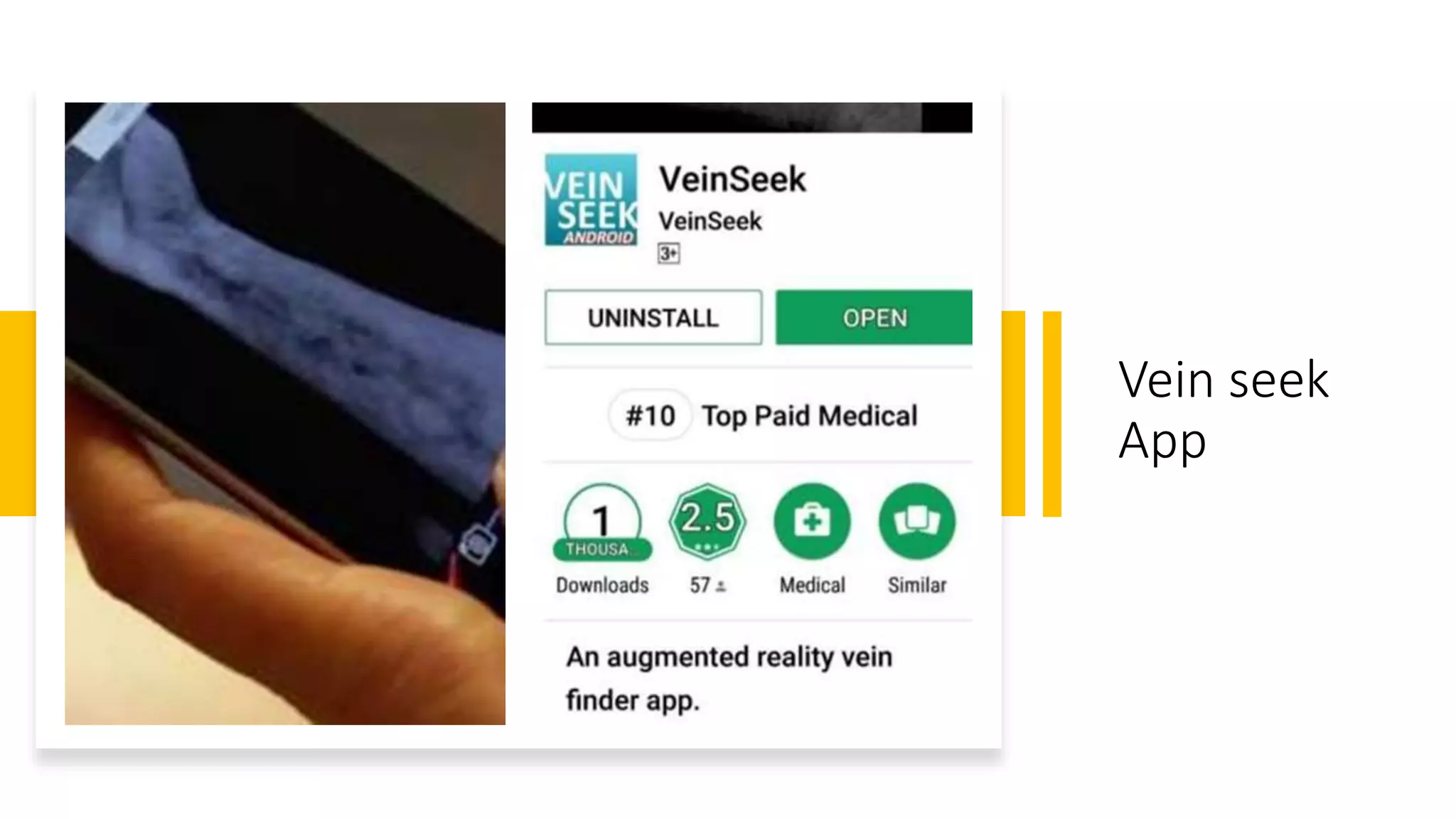 Vein seek
App
 