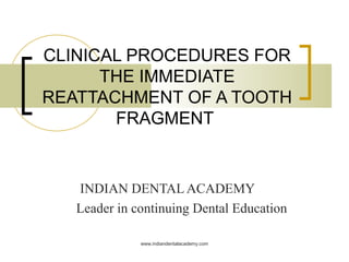 CLINICAL PROCEDURES FOR
THE IMMEDIATE
REATTACHMENT OF A TOOTH
FRAGMENT
INDIAN DENTAL ACADEMY
Leader in continuing Dental Education
www.indiandentalacademy.com
 