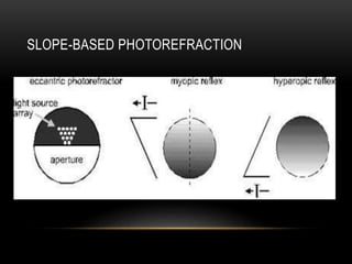 SLOPE-BASED PHOTOREFRACTION
 