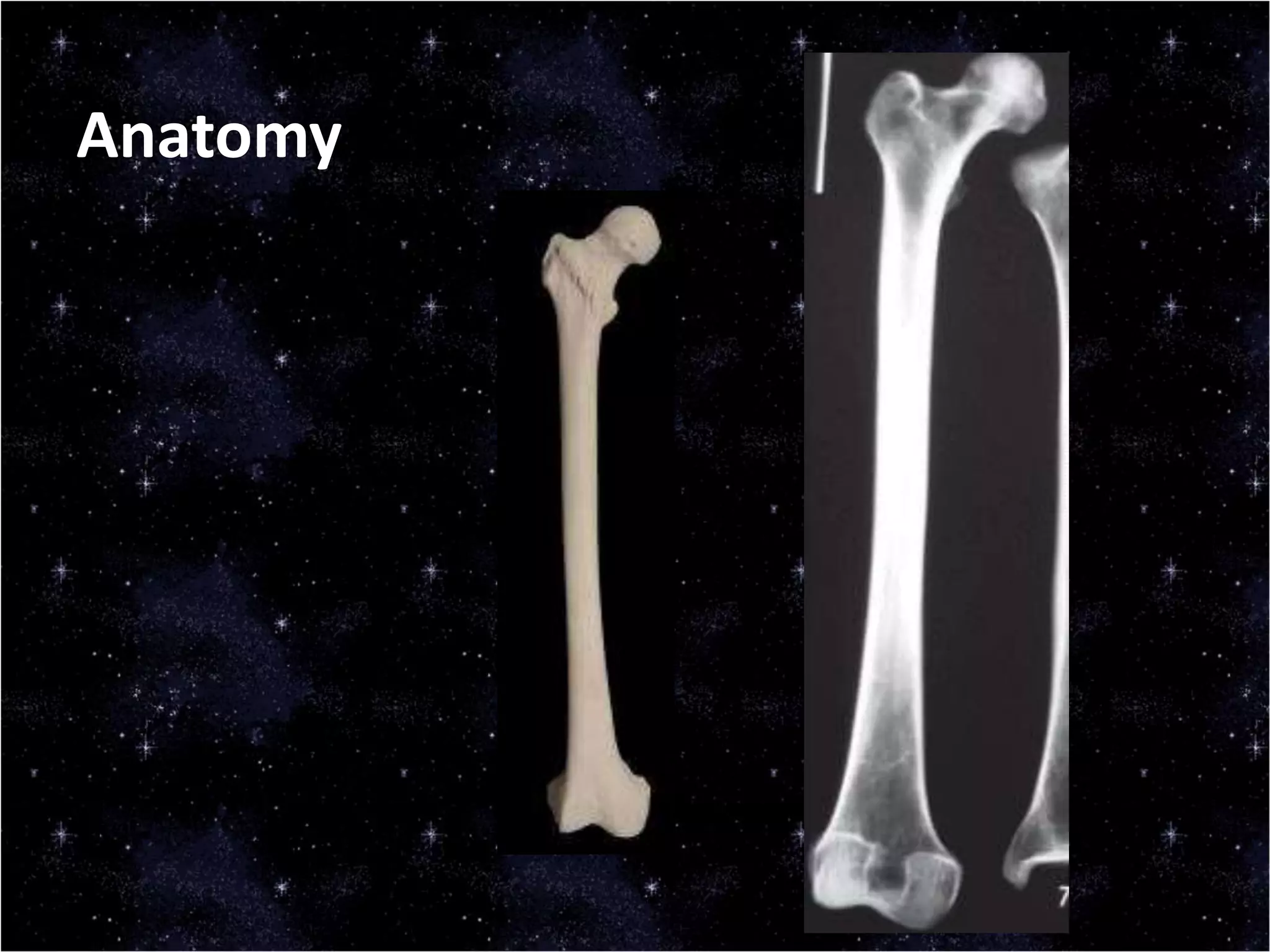 Anatomy