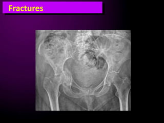 Clinical radiography for emergency doctors lower limb trauma | PPTX