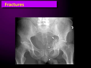 Clinical radiography for emergency doctors lower limb trauma | PPTX