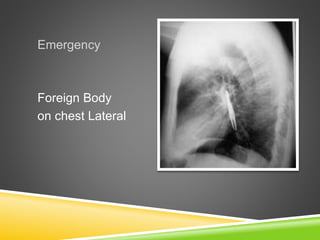 Clinical radiology slide share Slide 4