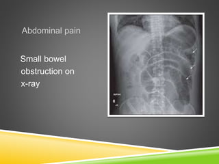 Clinical radiology slide share Slide 43