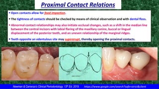 Tooth Contact Exceptions Clinical risk assessment & diagnosis of periodontal disease | PDF