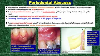 Clinical risk assessment & diagnosis of periodontal disease | PDF