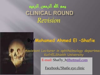 Revision
‫بسم‬‫هللا‬‫الرحمن‬‫الرحيم‬
By/Mohamed Ahmed El –Shafie
Assistant Lecturer in ophthalmology departmen
KafrELShiekh University
E-mail: Shaf3y_h@hotmail.com
Facebook/Shafie eye clinic
 