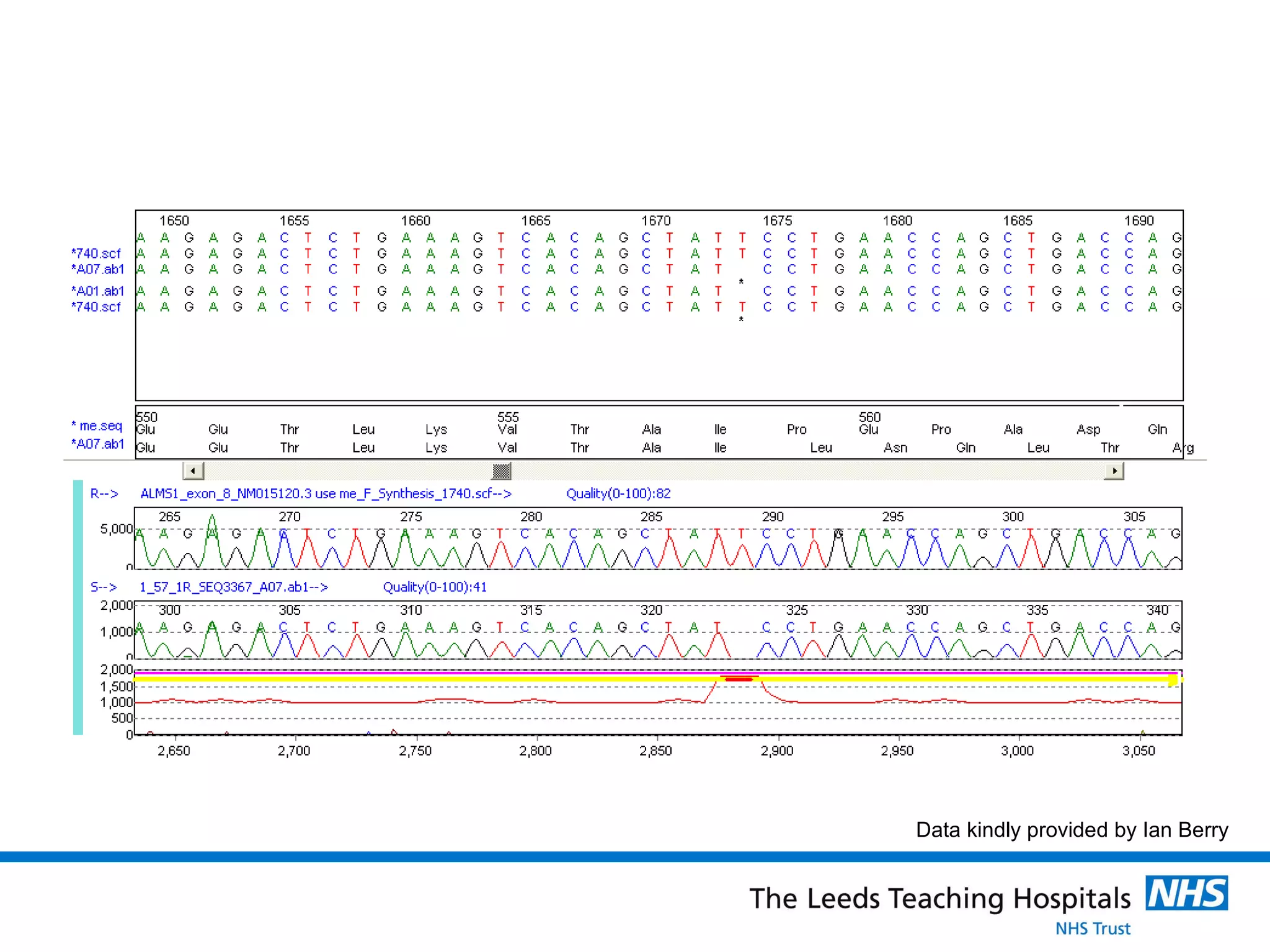 Data kindly provided by Ian Berry 