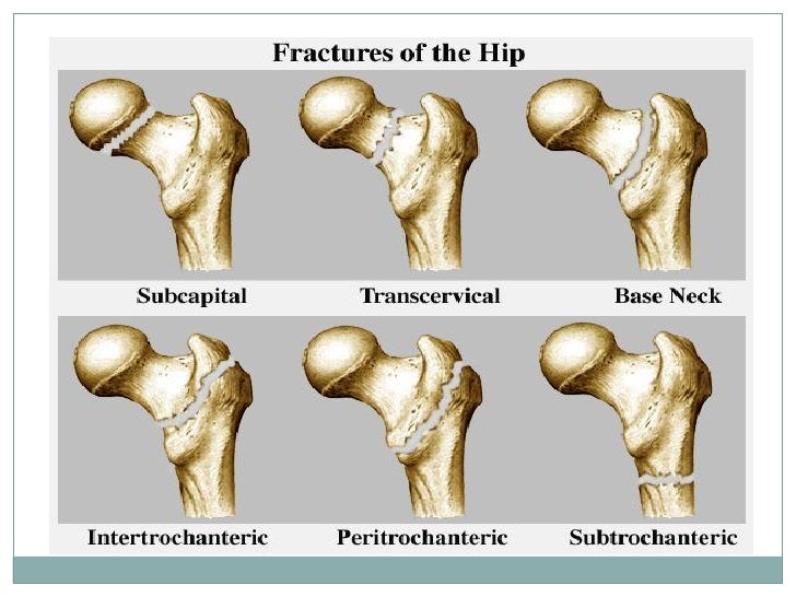 Clinical Serise Hip Widad