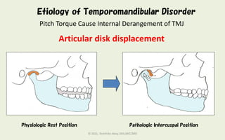 Clinical significance of first phase treatment for tmd final | PDF