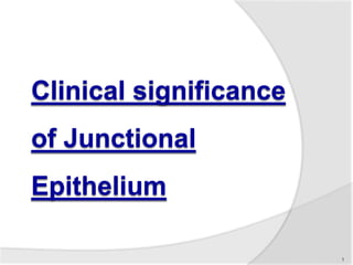 Clinical significance
of Junctional
Epithelium
1
 