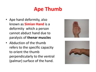 Clinical signs of upper limb | PPTX