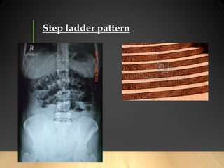 Step Ladder Radiography CXR and abdominal film interpretation for medical student | PDF