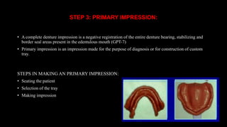 Clinical steps in fabricating a complete denture | PPTX