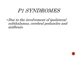 Due to the involvement of ipsilateral
subthalamus, cerebral peduncles and
midbrain
 