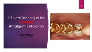 Clinical Technique for
Complex
Amalgam Retoration
1
Amir Rajaey
NKUM 2019-2020
 