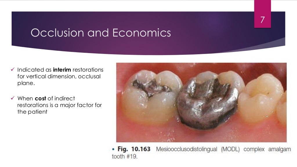 Clinical technique for complex Amalgam Restoration