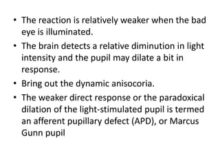 Clinical testing pupils | PPTX