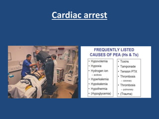 Cardiac arrest
 