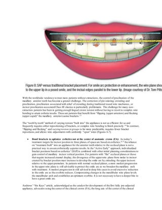 With the worldwide tendency to treat more patients without extractions, the control of proclination of the
maxillary anterior teeth has become a greater challenge. The correction of pre-existing crowding and
proclination, proclination associated with relief of crowding during traditional round wire mechanics, or
incisor proclination-associated Class III elastics is particularly problematic. The challenge for many non-
extraction patients has been in getting enough lingual crown torsion without having to resort to complex wire
bending to attain esthetic results. These are patients that benefit from “flipping (upper anteriors) and flocking
(upper cupid)” the maxillary anterior/canine brackets.13
The “tooth by tooth” method of varying torsion “built into” the appliance is not as efficient for us and
frequently requires either repositioning of brackets, or complex wire bending to finish precisely.14 In contrast,
“flipping and flocking” and varying torsion in groups is far more predictable, requires fewer bracket
repositions,and allows wire adjustments with uniformly “spun” wires (Figures 6-7).
 Bond brackets to optimize esthetics not at the center of anatomic crown (FA): As today’s
treatment targets for incisor position in three planes of space are based on esthetics,8,15 the reliance
on “treatment built” into an appliance for the anterior teeth relative to the occlusal plane is not a
practical way to ensure esthetically superior results.In the “Active Early” approach, individualized
bracket positions based on esthetics7 (SAP)is combined with other initial planning considerations to
gain control of maxillary incisor vertical position. For patients with “flat” occlusal planes or those
that require increased enamel display, the divergence of the upperwire plane from molar to incisor
created by bracket position must increase to develop the smile arc by extruding the upper incisors
relative to the upperpremolars. In patients with normal occlusal planes, a more modest progression
in the upper wire plane is still advisable to protect the smile arc as we broaden the maxillary arch
with treatment. A modest progression in still advised in deep bite cases to avoid excessive reduction
in the smile arc as the overbite reduces. Compensating changes in the mandibular wire plane levels
the mandibular arch and establishes an optimum overbite. It is not necessary to have a deeper bite to
have a great smile arc.
Andrews’ “Six Keys” article, acknowledged as the catalyst for development of the first fully pre-adjusted
appliance, advocates using the centerof the clinical crown (FA), the long axis of the center of the clinical
 