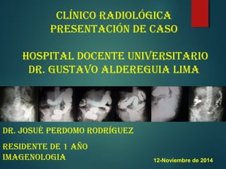 ClíniCo RadiológiCa
pResentaCión de Caso
Hospital doCente univeRsitaRio
dR. gustavo aldeReguia lima
dR. Josué peRdomo RodRíguez
Residente de 1 aÑo
imagenologia 12-Noviembre de 2014
 