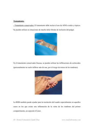 Dr. Homid Fahandezh-Saddi Díaz www.madridtrauma.com
Tratamiento:
- Tratamiento conservador: El tratamiento debe incluir el uso de AINEs orales y tópicos.
Se pueden utilizar en situaciones de mucho dolor férulas de inclusión del pulgar.
Si el tratamiento conservador fracasa, se pueden utilizar las infiltraciones de corticoides
(personalmente no suelo infiltrar más de una, por el riesgo de rotura de los tendones).
La RHB también puede ayudar para la resolución del cuadro especialmente en aquellos
casos en los que existe una inflamación de la vaina de los tendones del primer
compartimento, en especial el Láser.
 