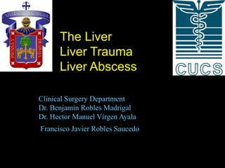 The Liver
      Liver Trauma
      Liver Abscess

Clinical Surgery Department
Dr. Benjamin Robles Madrigal
Dr. Hector Manuel Vírgen Ayala
Francisco Javier Robles Saucedo
 