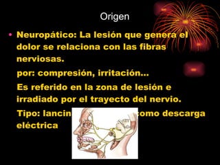 Origen Neuropático: La lesión que genera el dolor se relaciona con las fibras nerviosas. por: compresión, irritación… Es referido en la zona de lesión e irradiado por el trayecto del nervio. Tipo: lancinante, urente, como descarga eléctrica 