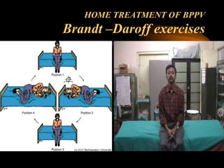 Vertigo Exercise .pdf Clinic based management of vertigo. | PPT