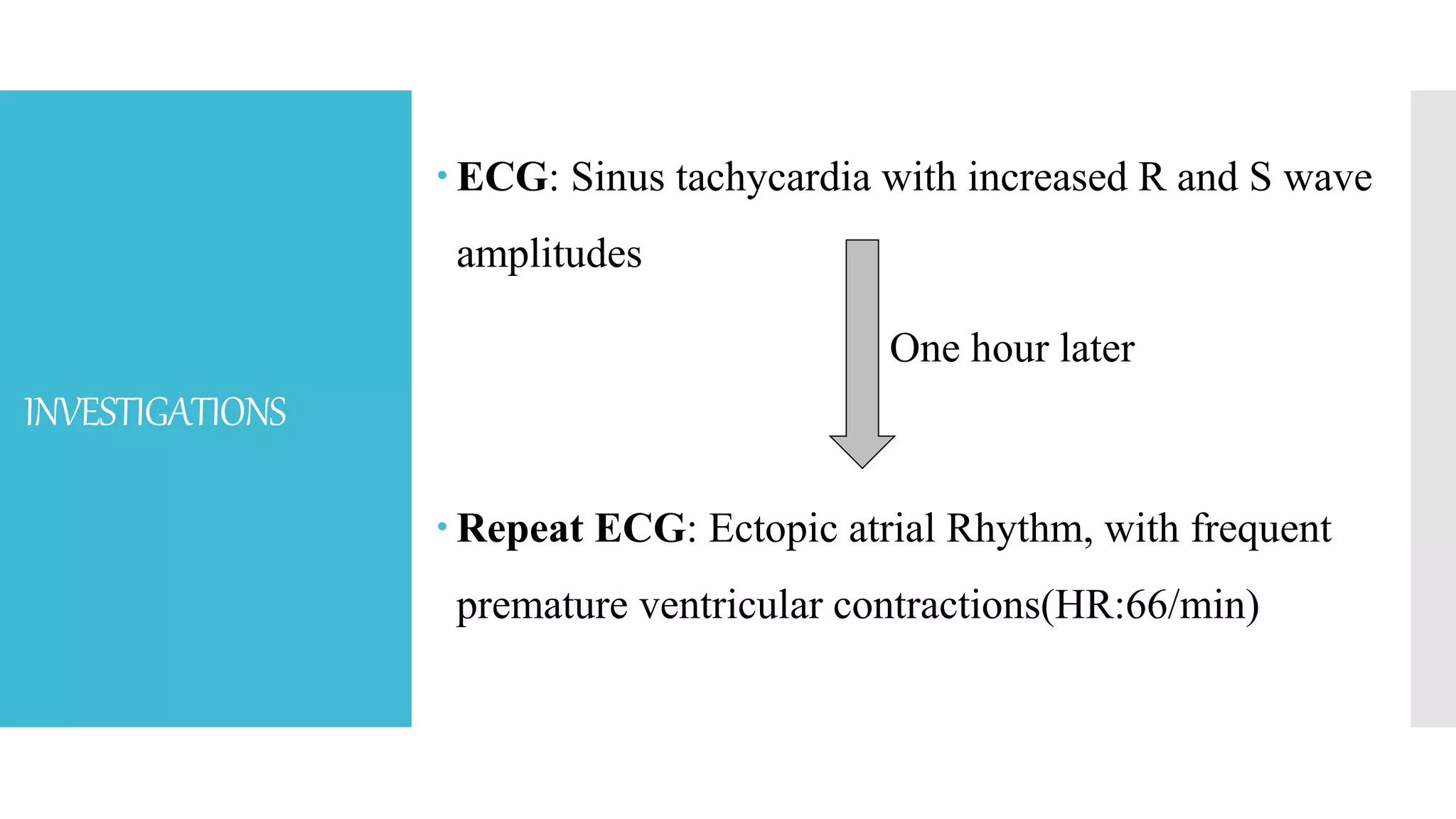 INVESTIGATIONS
 ECG: Sinus tachycardia with increased R and S wave
amplitudes
One hour later
 Repeat ECG: Ectopic atrial Rhythm, with frequent
premature ventricular contractions(HR:66/min)
 