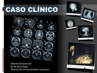 Alberto Galiana Ivars
R1 de Neurología
Reunión de clínicos leoneses 17/4/2010
 