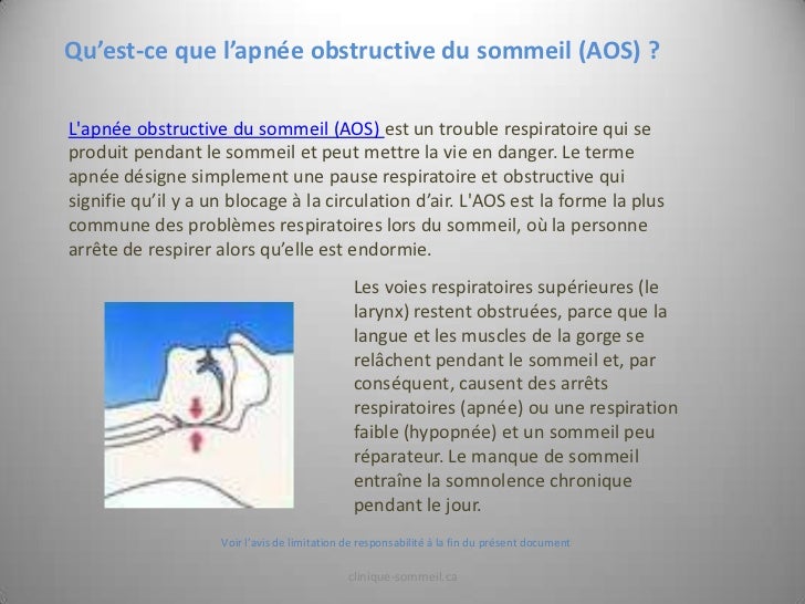 Comment Diagnostiquer Un Syndrome D’Apnées Obstructives Du Sommeil – WTRDQ