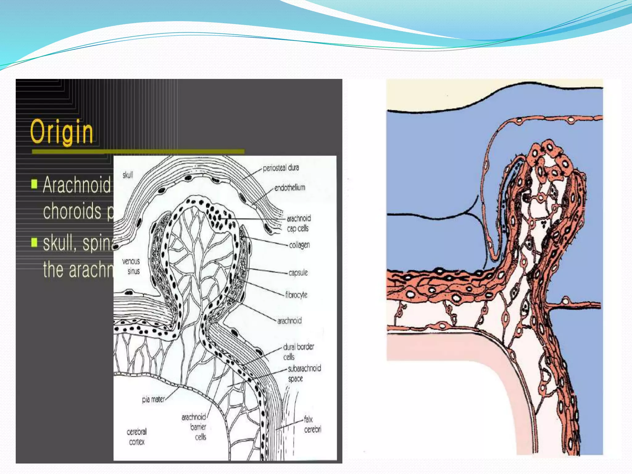 Clinoidal meningioma | PPTX