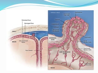 Clinoidal meningioma | PPTX