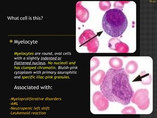 Clinical Pathology Block 1 Photos Study Questions_Mari-Alina Timoshchuk ...