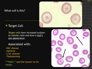 Clinical Pathology Block 1 Photos Study Questions_Mari-Alina Timoshchuk ...