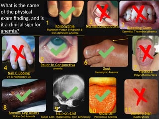 Sign Vinson Clinical Pathology Block 1 Photos Study Questions_Mari-Alina Timoshchuk ...