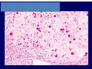 Clinical Pathology Block C Images Study Questions_Mari-Alina Timoshchuk ...