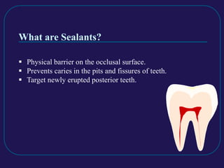 What are Sealants?
 Physical barrier on the occlusal surface.
 Prevents caries in the pits and fissures of teeth.
 Target newly erupted posterior teeth.
 