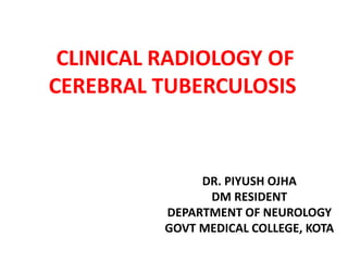 CLINICAL RADIOLOGY OF
CEREBRAL TUBERCULOSIS
DR. PIYUSH OJHA
DM RESIDENT
DEPARTMENT OF NEUROLOGY
GOVT MEDICAL COLLEGE, KOTA
 