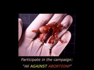 Participate in the campaign: “ All  AGAINST  ABORTION !” 