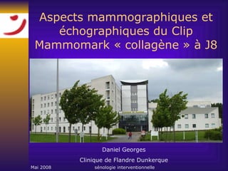 Aspects mammographiques et échographiques du Clip Mammomark « collagène » à J8 Daniel Georges Clinique de Flandre Dunkerque 
