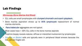 Normal Marrow Elements Chronic Lypmhocytic leukemia/SLL/B-PLL/T-PLL/ATLL By SOLOMON SUasb by | PDF