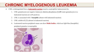 Cml Diff Slide CLL. CML.pptx