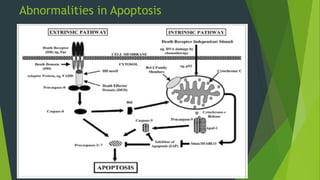 Abnormalities in Apoptosis
 